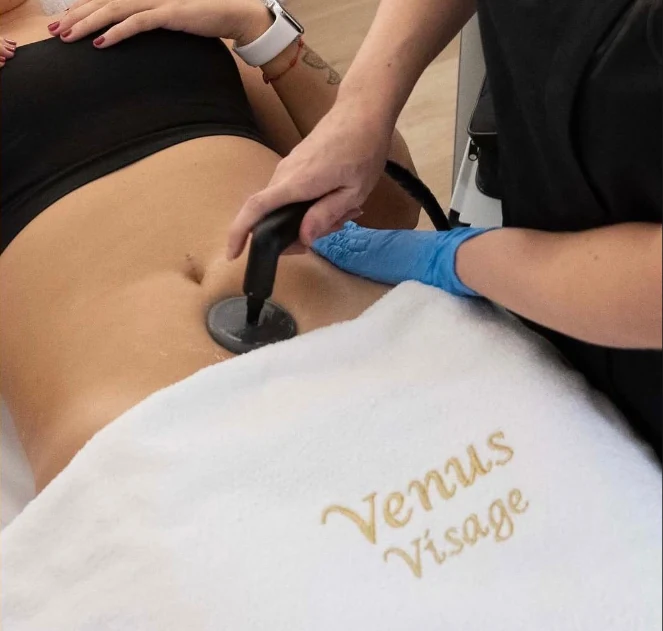 Tratamiento Indiba corporal en Venus Visage